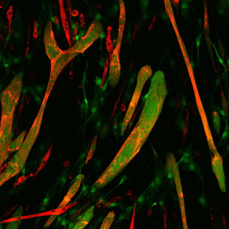 Expression of myomaker in fibroblasts (green) induces fusion with myoblasts (red) resulting in yellow/orange chimeric myotubes.